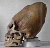 Apparent skull of alien-human hybrid